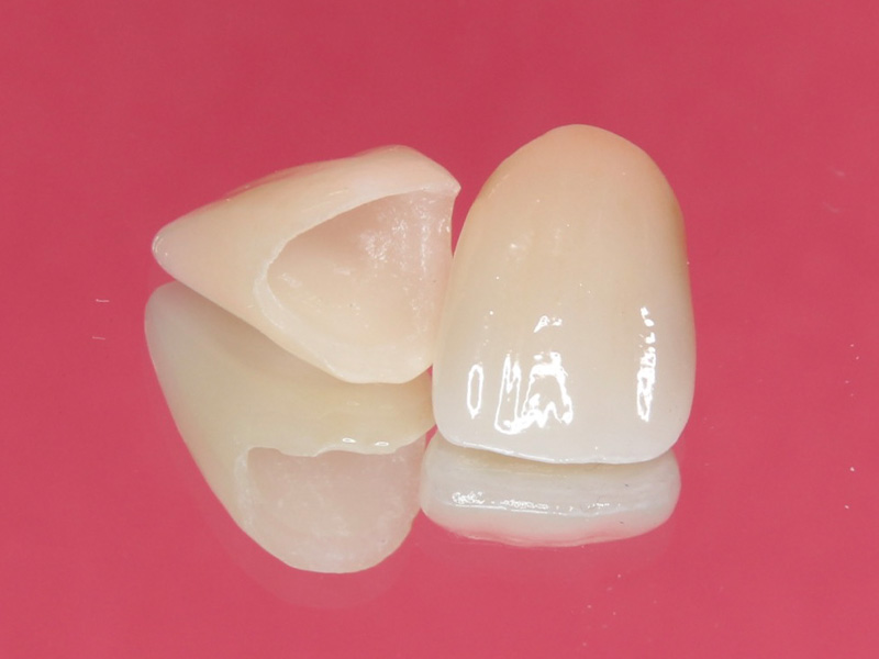 クラウン・ブリッジ