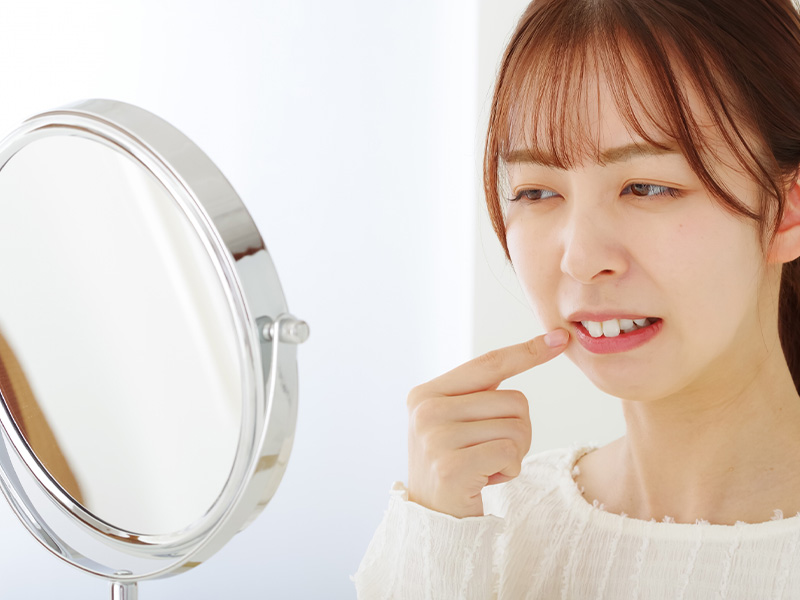 歯の欠損などの補綴