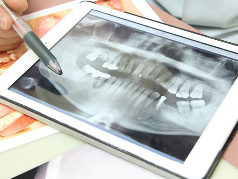 矯正歯科について