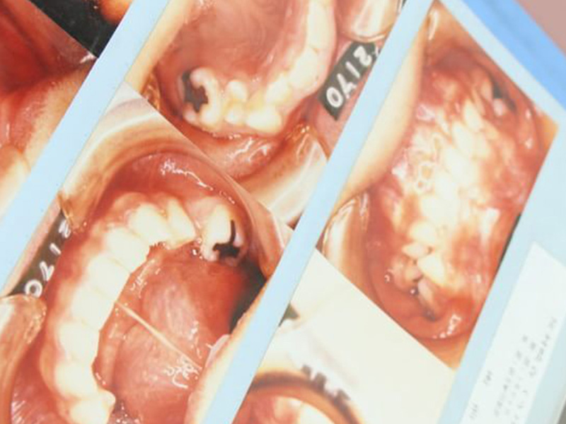 後戻りを防ぐことに力を入れた計画的な矯正治療をいたします