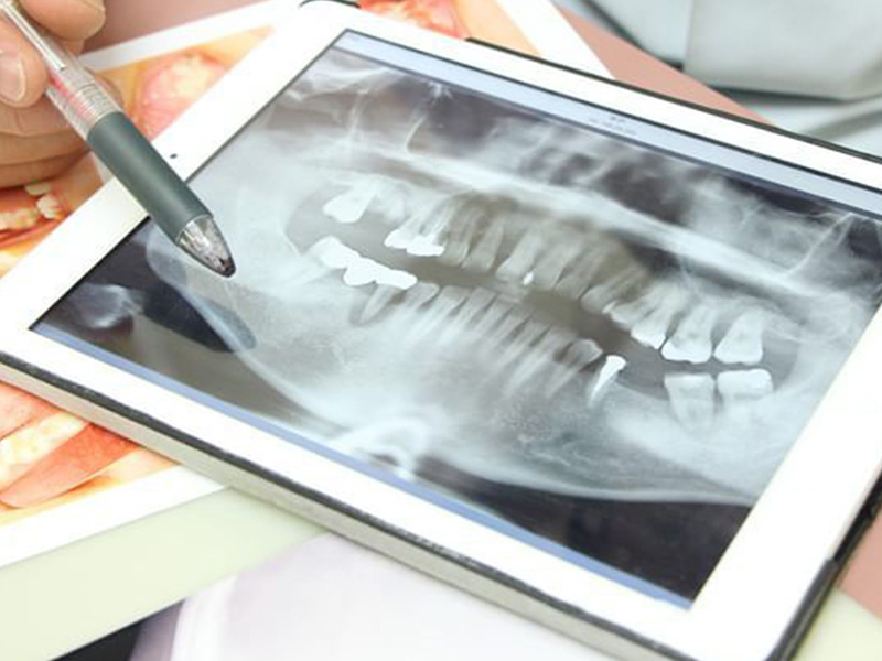 矯正治療計画のご説明